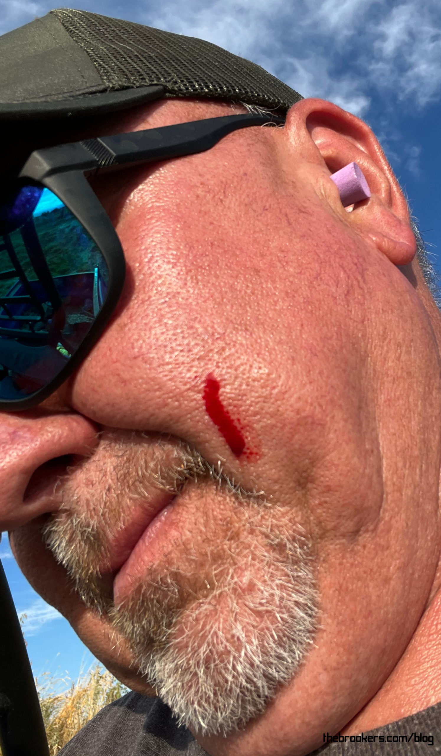 Ouch!