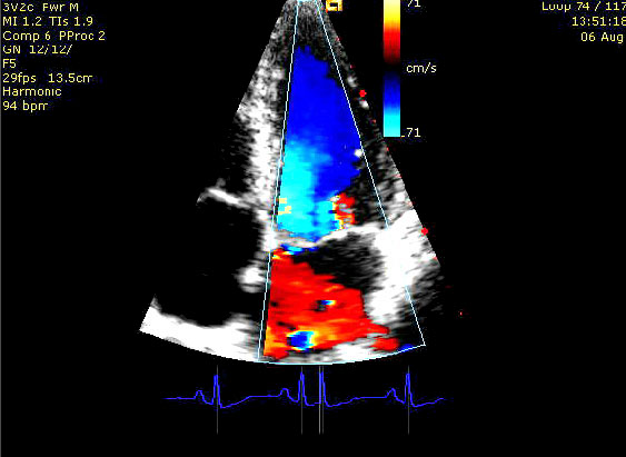 Electrocardiogram