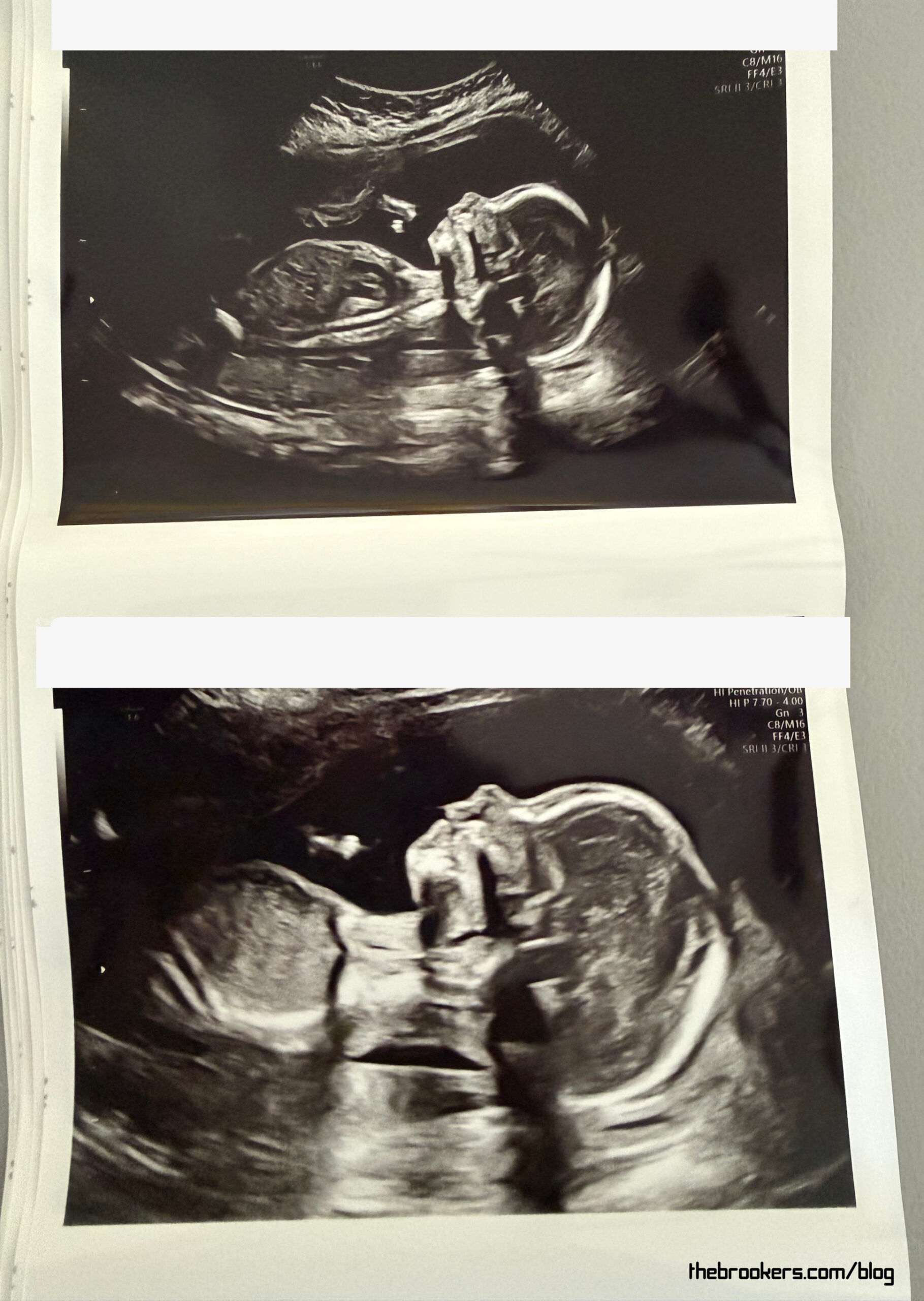 20 weeks 9 20 weeks